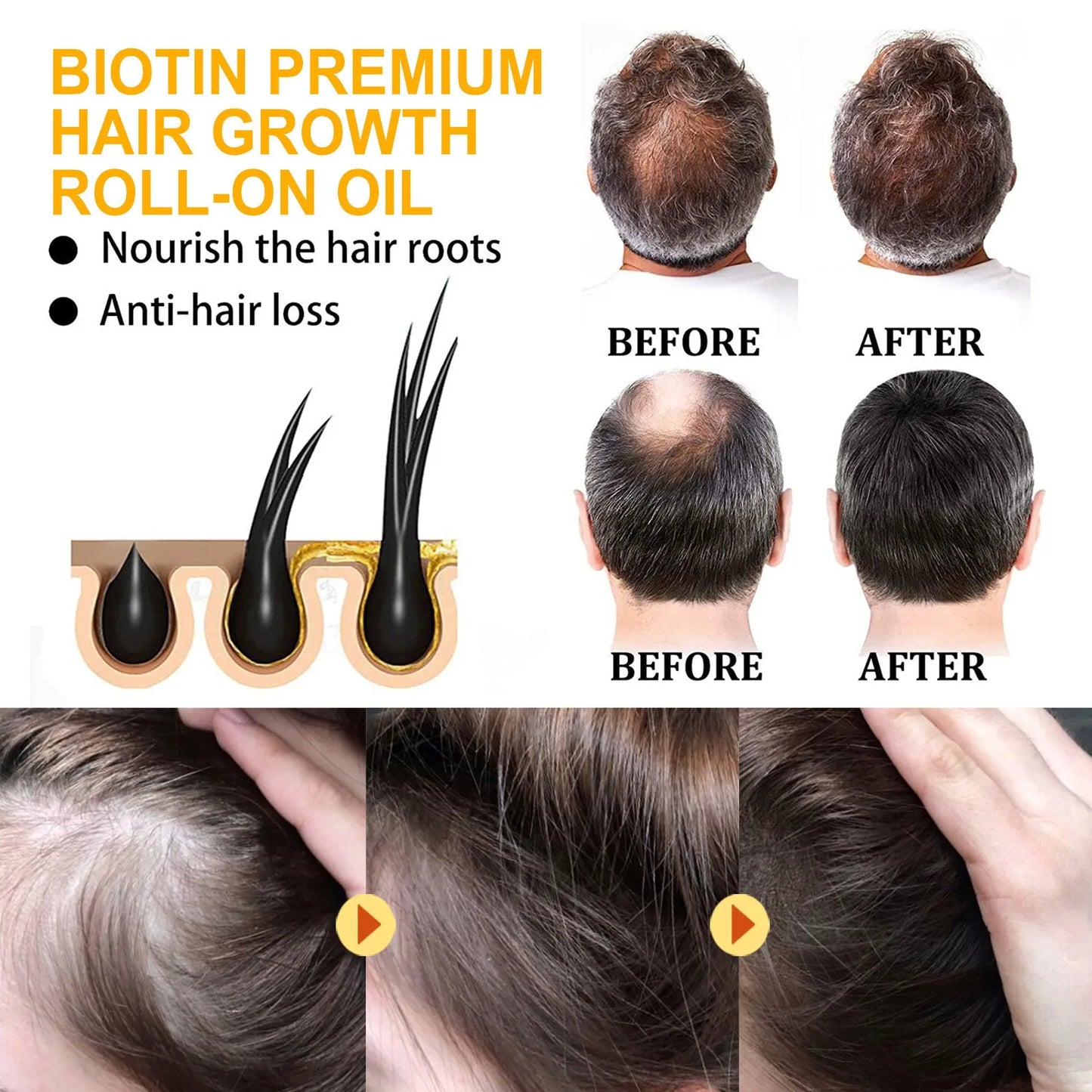FysionX Biotin Growth